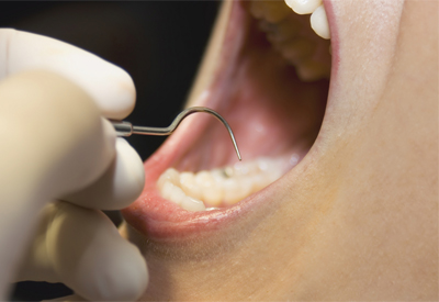 Dangers of Gum Disease Wallingford, CT