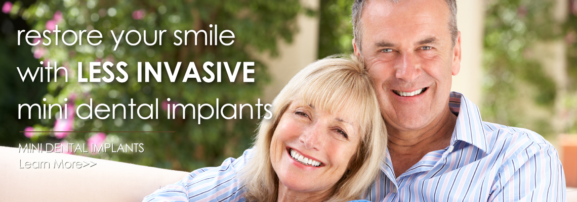 Mini dental implants